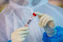 В Узбекистане выявили 39 новых случаев заражения коронавирусом