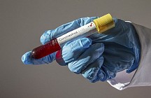 Выявлены новые случаи заражения коронавирусом в Узбекистане