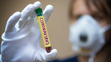 Новые случаи инфицирования коронавирусом подтверждены в Узбекистане 