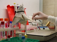 В Таджикистане зарегистрирован 171 новый случай коронавируса