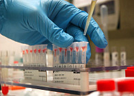 Kedrion Biopharma наладит производство препарата для лечения гемофилии в Ташкенте