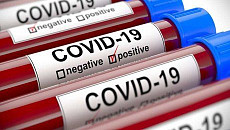 Число зараженных коронавирусом в Узбекистане приблизилось к 2,8 тыс.